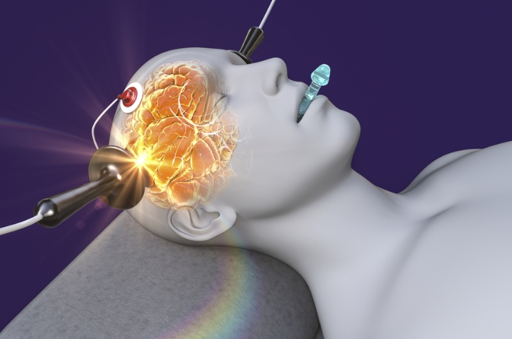 Electroconvulsive Therapy (ECT)-----25